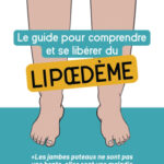 le-guide-pour-comprendre-et-se-liberer-du-lipoedeme-9782807377523 le-guide-pour-comprendre-et-se-liberer-du-lipoedeme-9782807377523